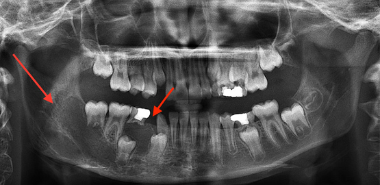Dental-Radiography