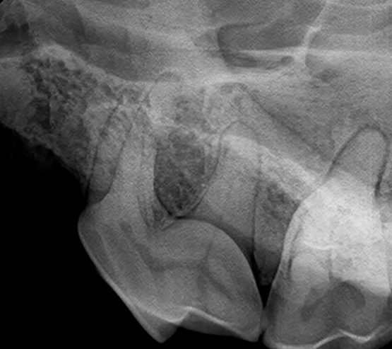 Dental-Radiography
