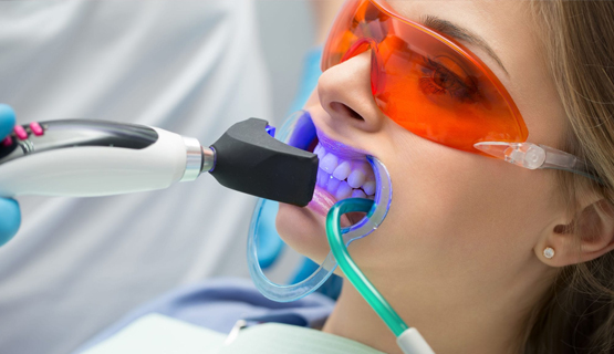 Whitening-with-restorations