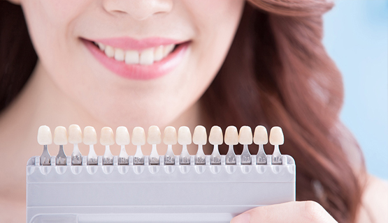 teeth-whitening